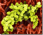 Staphylococcus aureus
